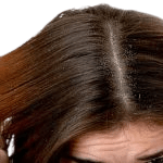 Hair